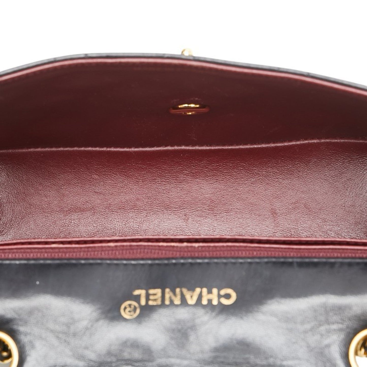 STRAPSTORY MIX BAG - 271