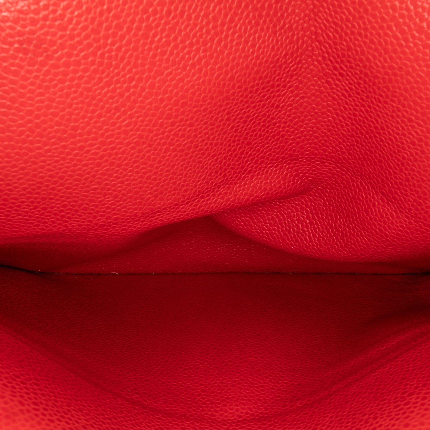 STRAPSTORY MIX BAG - 835